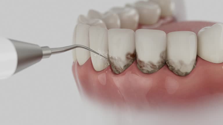 Reliable Teeth Cleaning And Checkup contractor in Barber County County, KS by Dentist Open Now